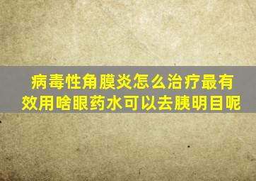 病毒性角膜炎怎么治疗最有效用啥眼药水可以去胰明目呢